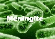 meningite