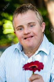 sindrome down
